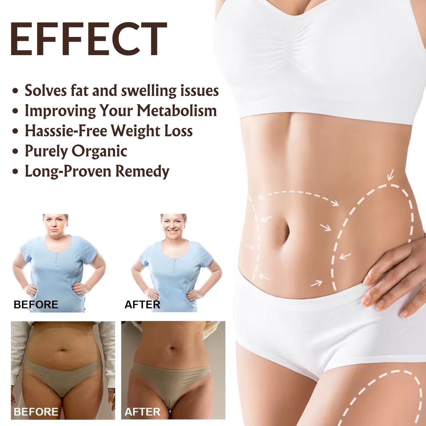Magic Secret Silicone Anti Stretch Mark Stomach Patches