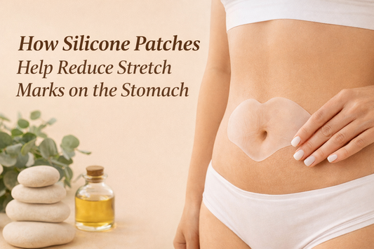 How Silicone Patches Help Reduce Stretch Marks on the Stomach?