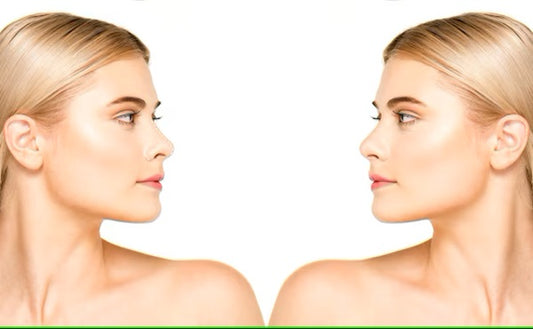 Debunking Myths About Face Lifting Devices: Separating Fact from Fiction