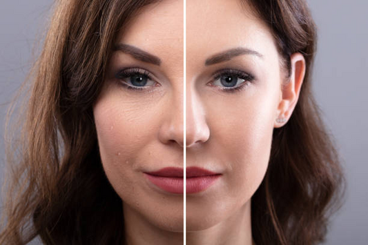Smart V Lift Face Contouring Device 