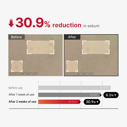 Medicube Red Body Peeling Shot, AHA + BHA Exfoliating Body Spray