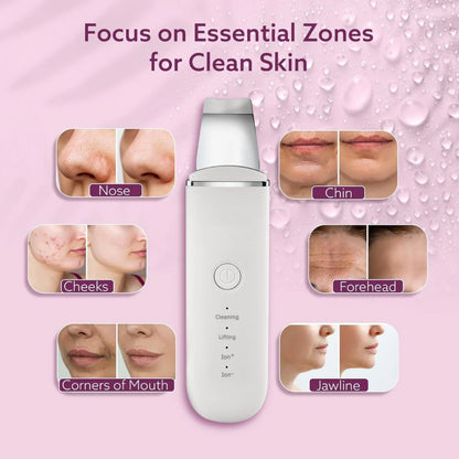 Skin Scrubber Face Spatula Skin Spatula Pore Cleaner Blackhead Remover Tools for Facial Deep Cleansing-4 Modes -White