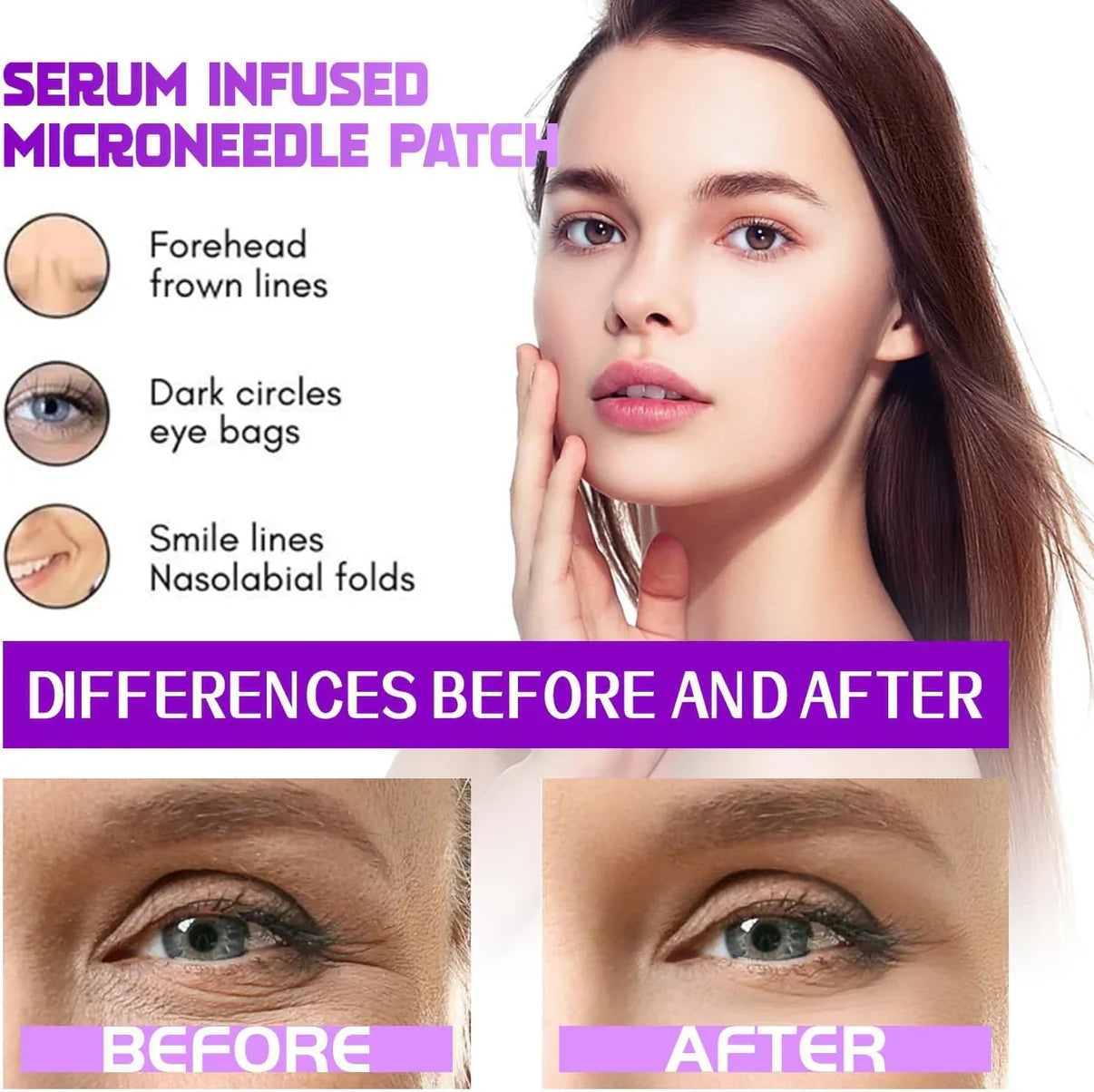 Microneedling Eye Patches