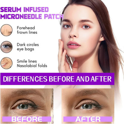 Microneedling Eye Patches