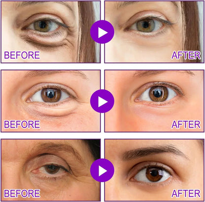 Microneedling Eye Patches