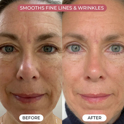 Magic Secret PDRN Pink Collagen Mask