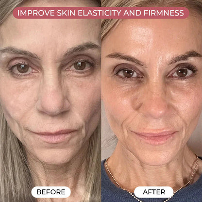 Magic Secret PDRN Pink Collagen Mask